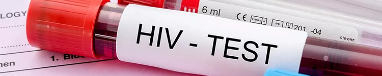 Анализы на ВИЧ в Подольске